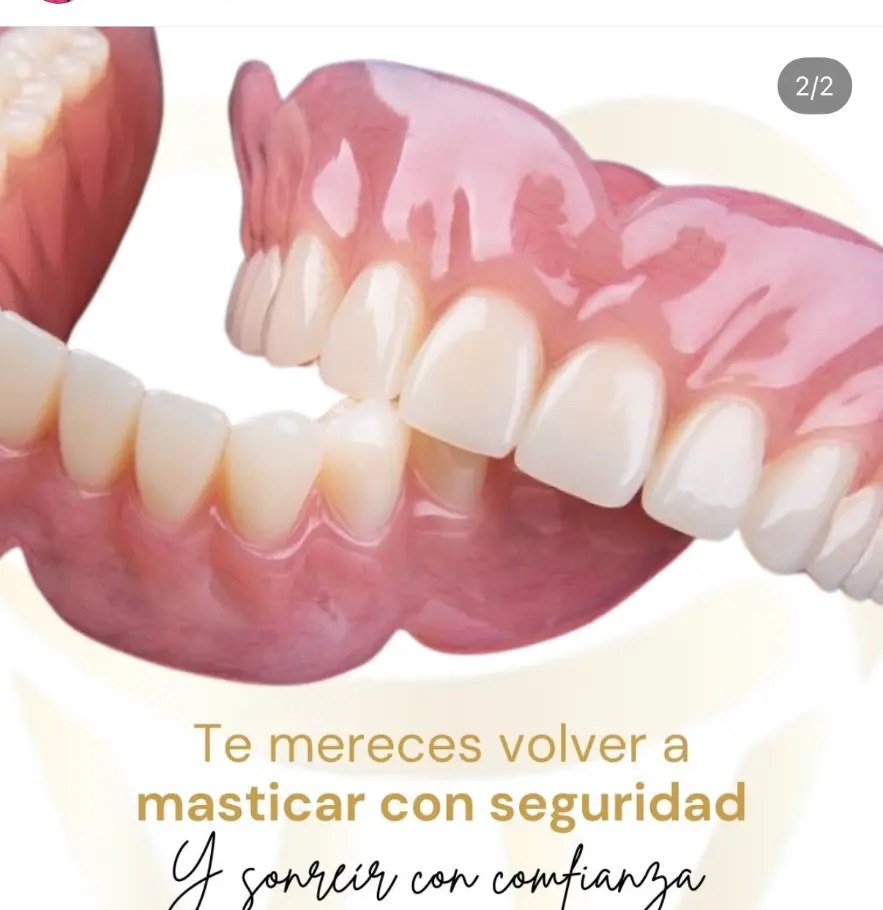 Modelo dental que muestra una arcada completa para explicar implantes