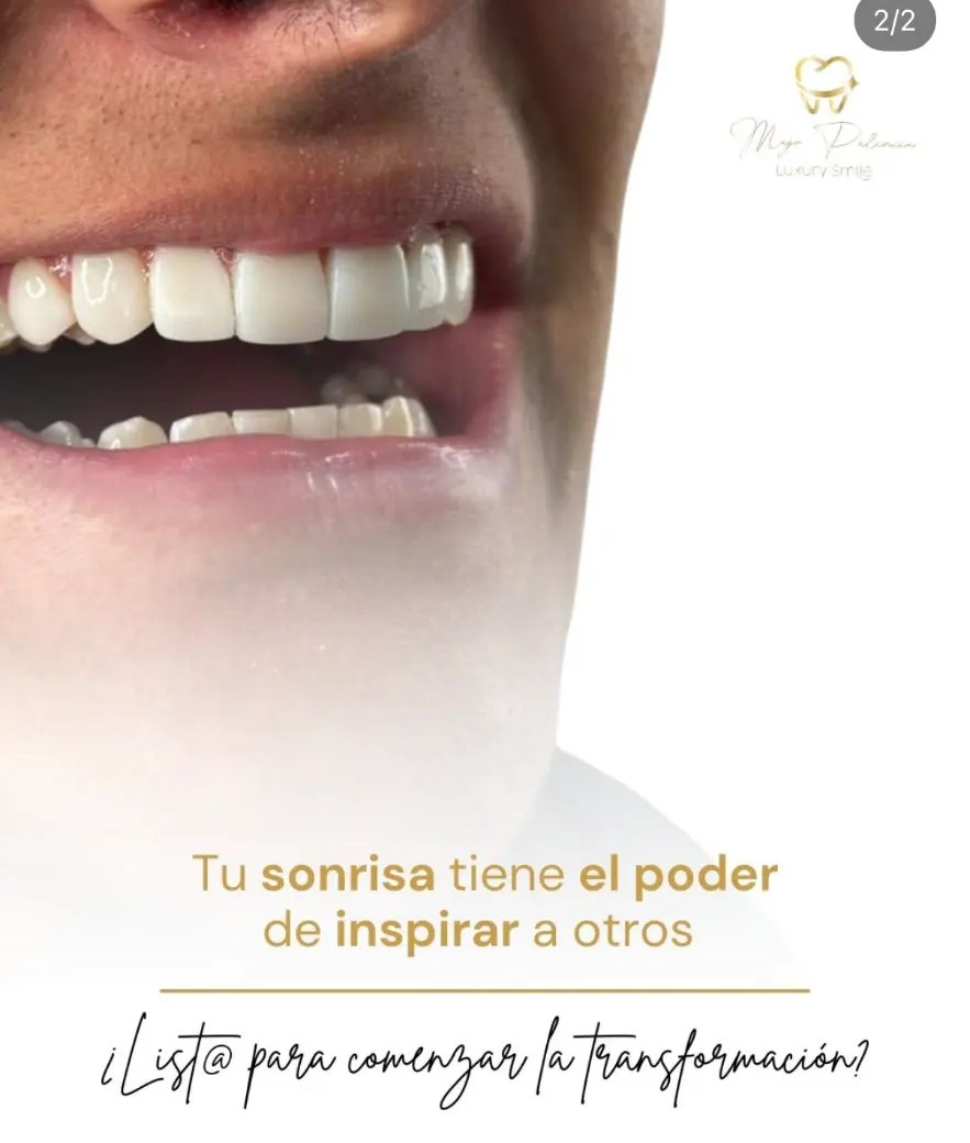 Sonrisa luminosa después de un blanqueamiento dental